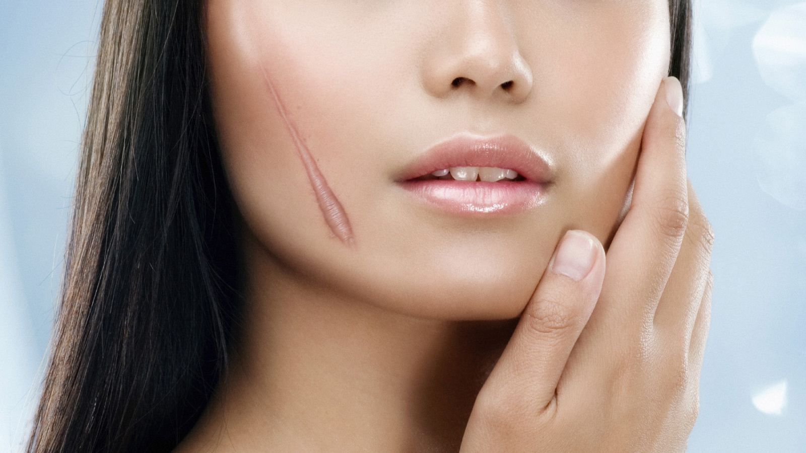 Làm Thế Nào Để Điều Trị Khỏi Sẹo Lồi