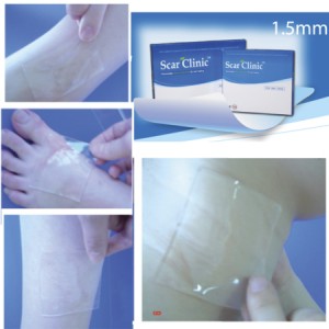 BĂNG DÁN ĐIỀU TRỊ VÀ NGĂN NGỪA SẸO SCAR CLINIC
