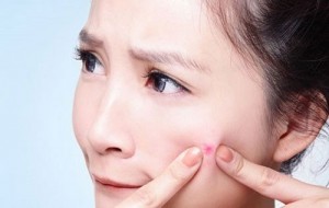 LÀM MỜ SẸO DO MỤN ĐỂ LẠI