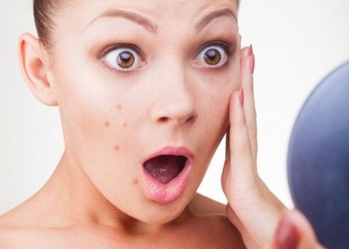 Biện pháp khắc phục viêm da dị ứng tại nhà