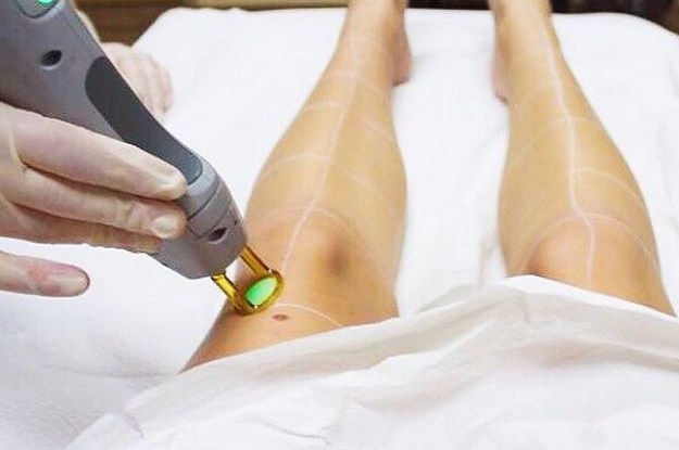 ​CÁC PHƯƠNG PHÁP TRIỆT LÔNG HIỆU QUẢ
