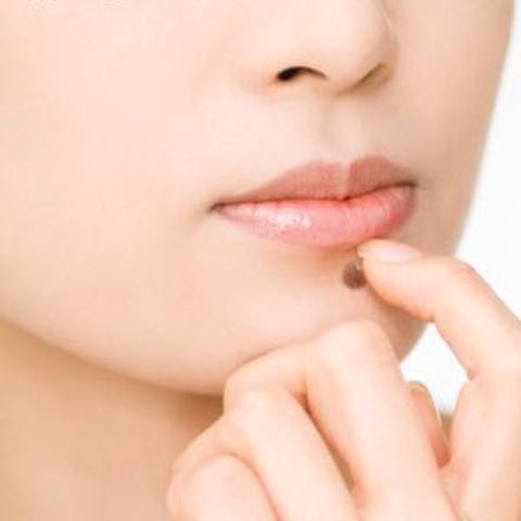 XÓA NỐT RUỒI AN TOÀN KHÔNG ĐỂ LẠI SẸO