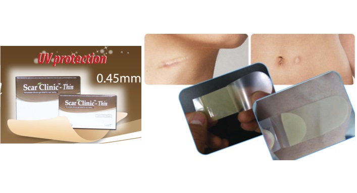Miếng dán trị sẹo Scar Clinic